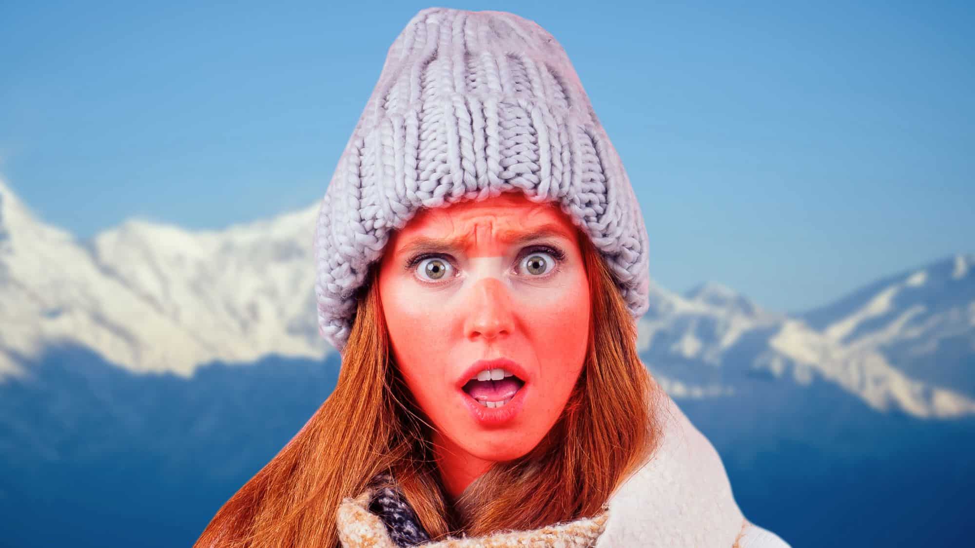 A woman in winter gear stands against a snowy mountain backdrop, her face visibly sunburned except for pale goggle lines, with a shocked expression under a chunky knit beanie.